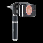 3,5 V LED MacroView Plus Otoskop für iExaminer (mit kostenloser App)