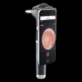3,5 V LED MacroView Plus Otoskop für iExaminer (mit kostenloser App)