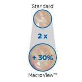 MacroView™ Prestige™ Otoskop-Set
